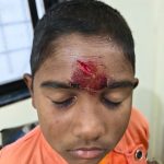 धक्कादायक….! जि प शाळा वाडा पुनर्वसन गावठाण वढू बुद्रुक मध्ये मुलगा जखमी पालकांना समजेना काय झाले 