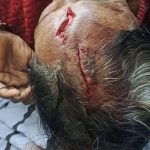 ब्रेकिंग…! अष्टापुरात बिबट्याचा महिलेवर हल्ला अंजना कोतवाल गंभीर जखमी