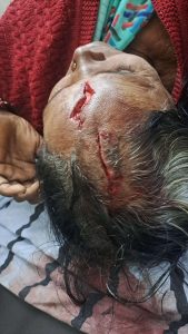 ब्रेकिंग…! अष्टापुरात बिबट्याचा महिलेवर हल्ला अंजना कोतवाल गंभीर जखमी